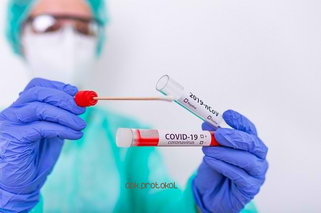 Rapid Diagnostic Test Antigen Resmi Digunakan untuk Penyelidikan Epidemiologi